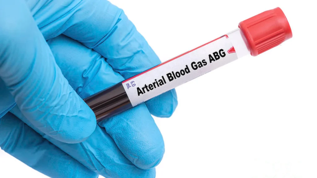 Arterial Blood Gas Test Purpose, Procedure & Benefits