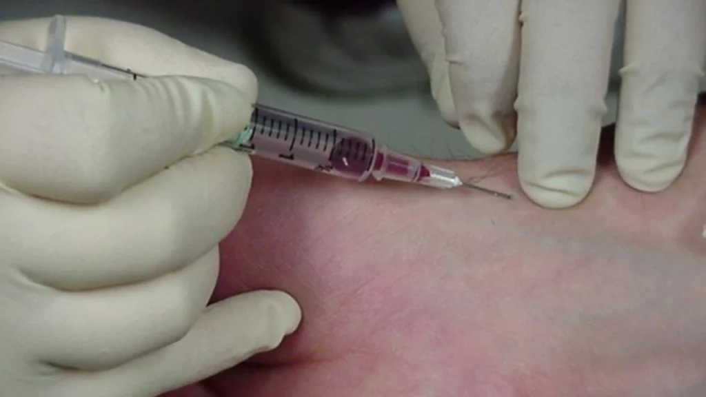 Can You Get an Arterial Blood Gas Test at Home