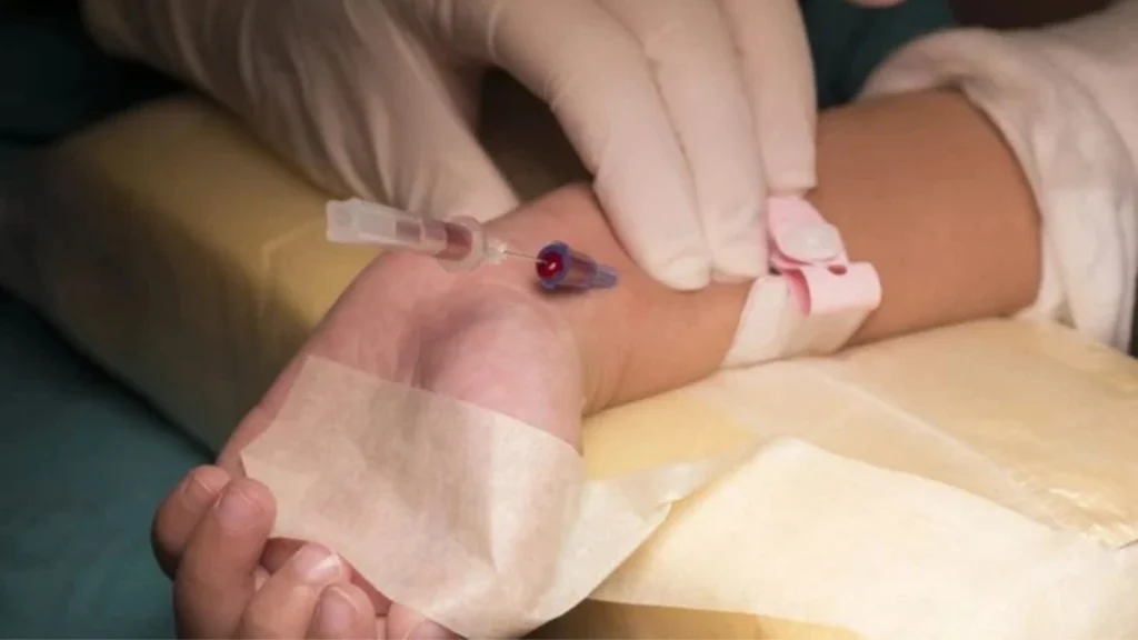 Common Mistakes or Myths About ABG Testing
