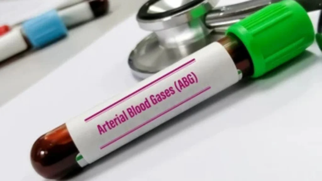 Understanding Your ABG Results