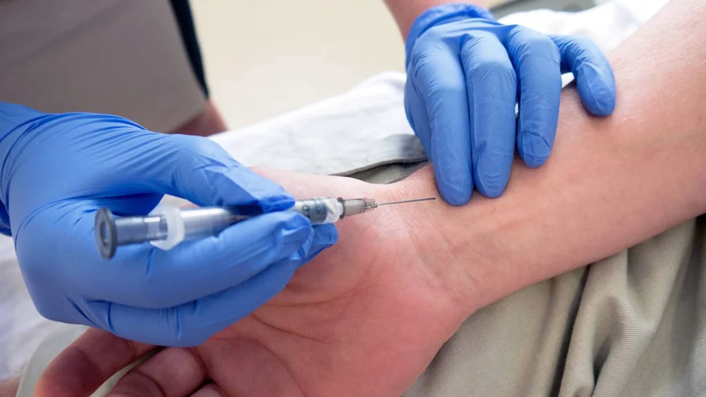 Why Doctors Recommend an Arterial Blood Gas Test