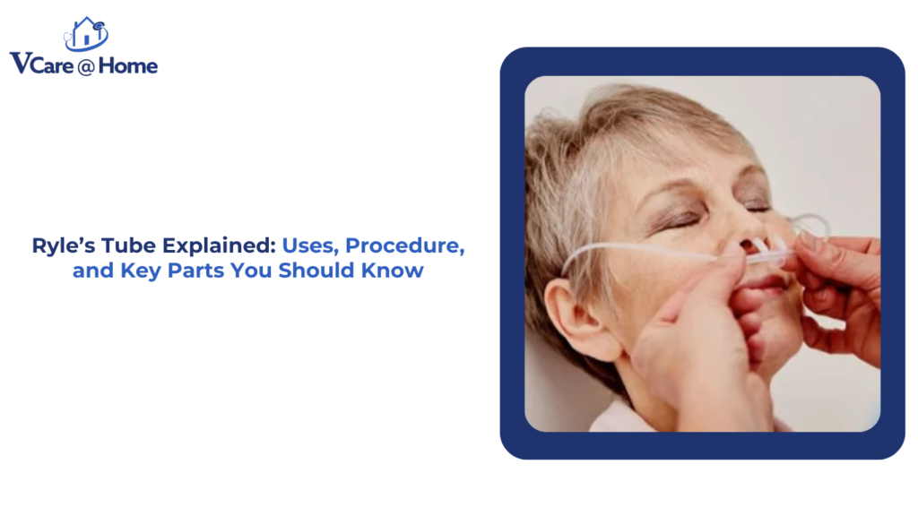Ryle’s Tube Explained: Uses, Procedure, and Key Parts You Should Know
