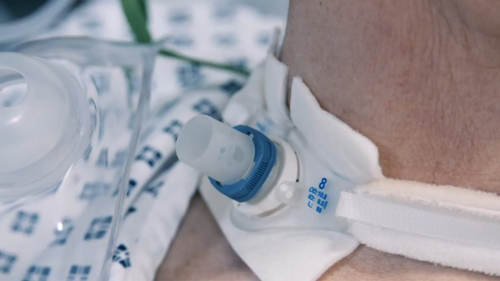 Best Practices for Tracheostomy Tube Care